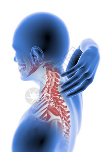 颈部按摩仪人类X射线颈部疼痛插画