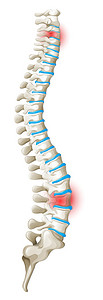 斯凯尔脊椎背痛图解插画
