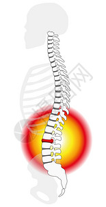 局部腰部视图人类脊椎柱的圆锥状或滚落剖析视图白背景上的孤立矢量插图单插画