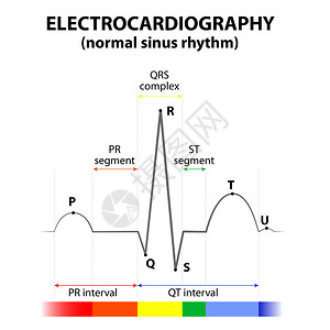 以正常鼻弦节奏的心脏ECG示意图表达式背景图片