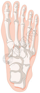 用于痛风脚趾插图的骨x射线图片