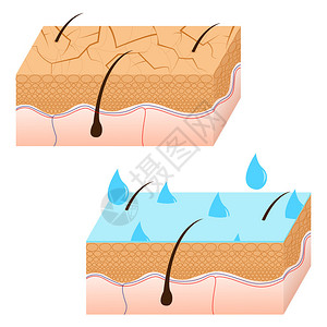 皮肤水合和干皮肤部分图片