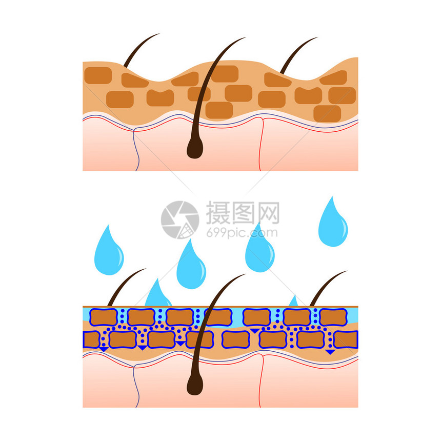 皮肤水合和干皮肤部分图片