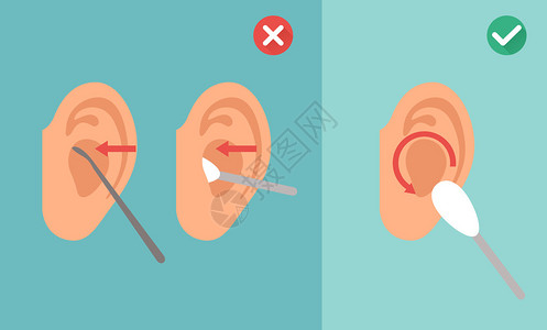 清理耳朵的正确方法错图片