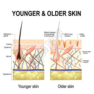 纤维细胞人体皮肤变化或皮肤老化插画