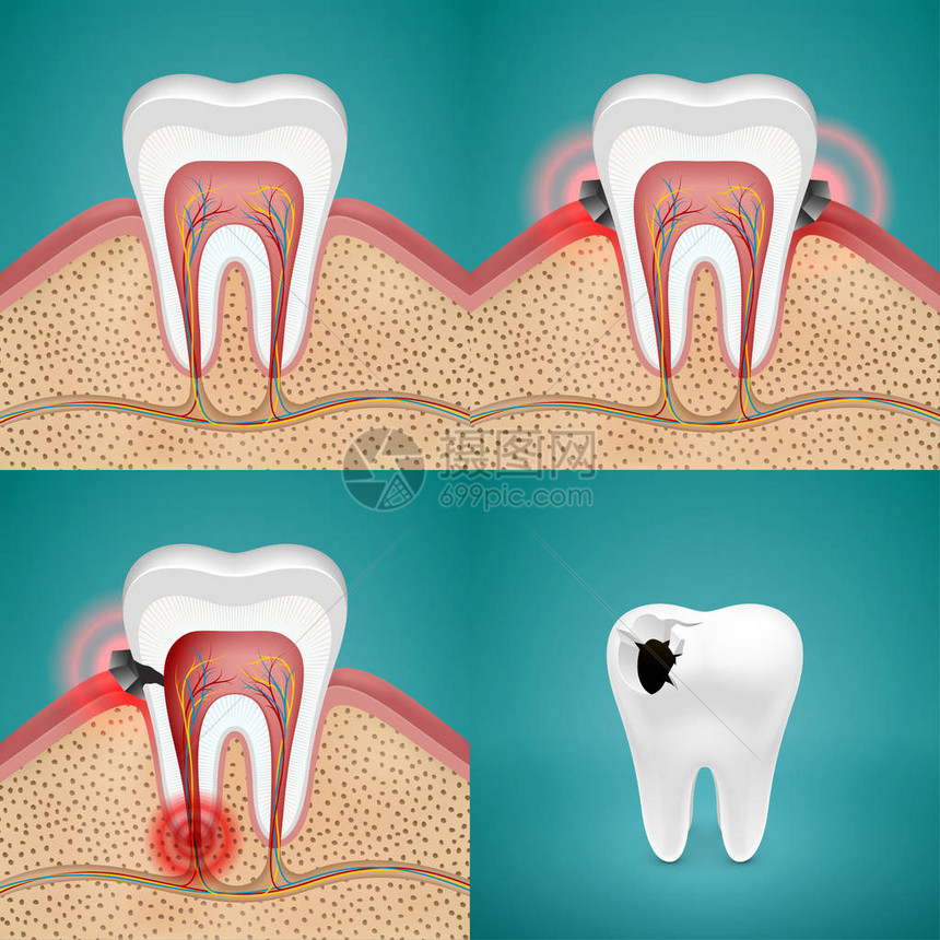 牙痛概念图片