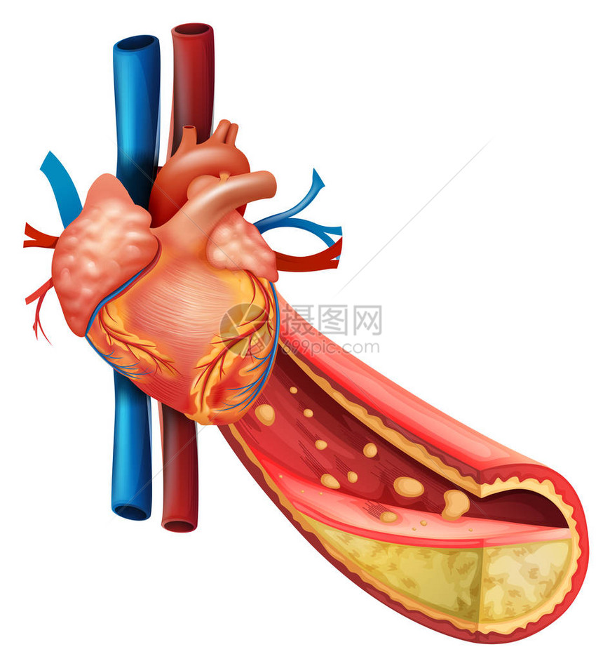 显示人类心脏和脂肪血图片