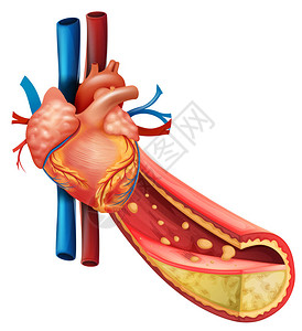 显示人类心脏和脂肪血图片