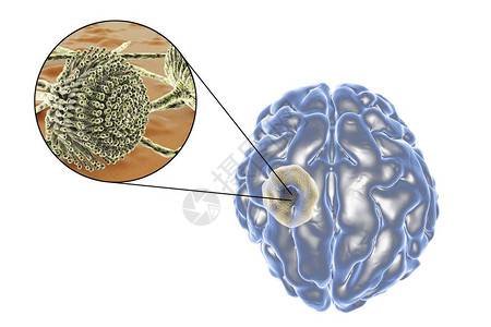 足菌肿脑曲霉菌和真菌曲霉菌的特写视图设计图片