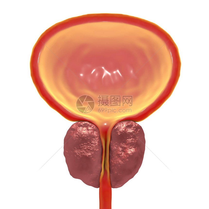 3D显示前列腺扩大的3D图图片