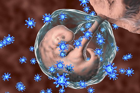 风疹围产期感染传播设计图片