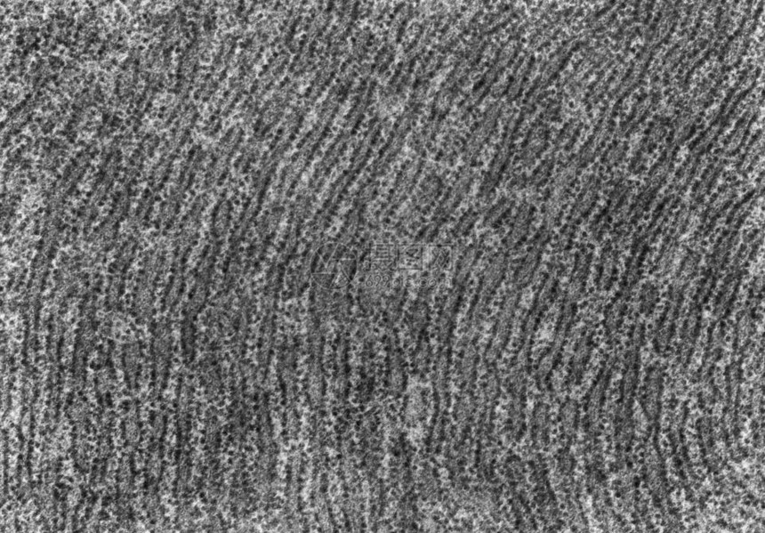 传输电子显微镜TEM显微图显示蛋白合成细胞的细胞多孔图片