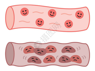 流利度健康血管和堵塞的长着可爱字眼的动设计图片