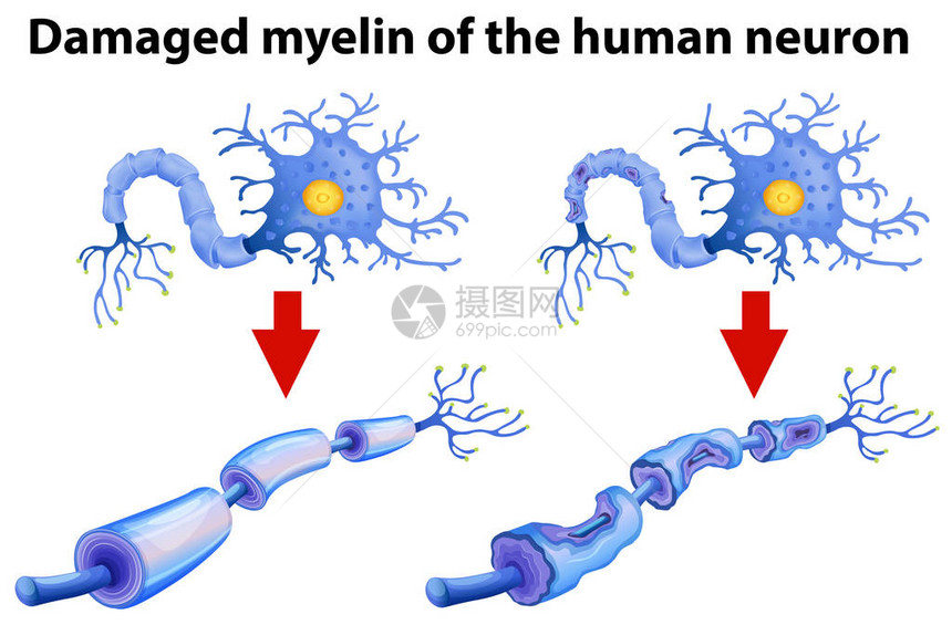 人类中世纪图解的图片