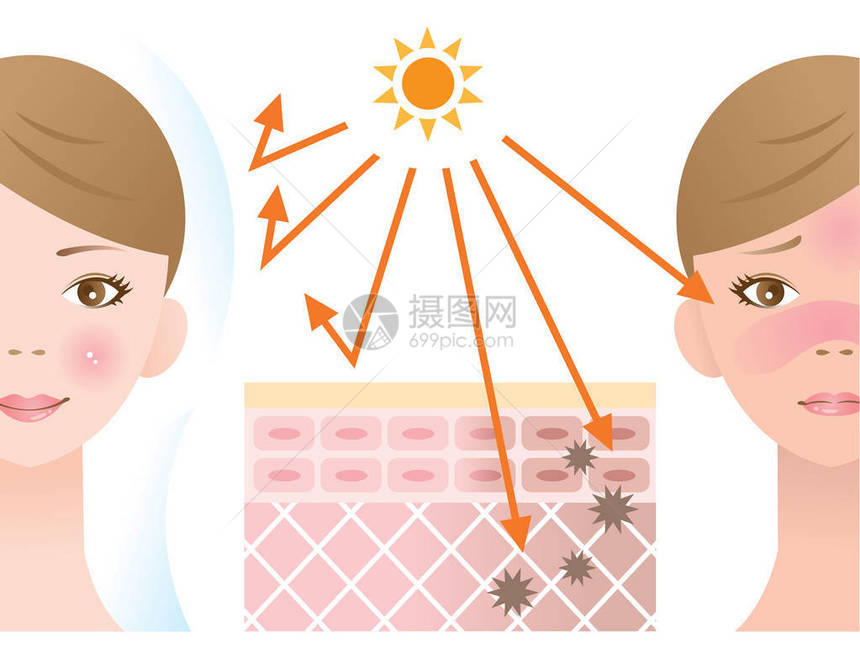 防晒霜的皮肤图示保护皮肤免受紫外线的影响图片
