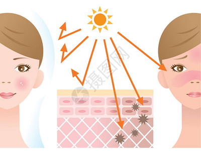 防晒霜的皮肤图示保护皮肤免受紫外线的影响图片