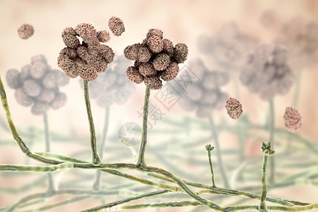 双子叶植物纲会导致霉菌中毒慢疲劳过敏疾病和其他健康问题设计图片