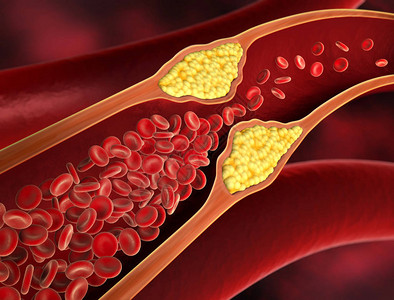 梗阻红细胞血管变窄Erythrozyt设计图片