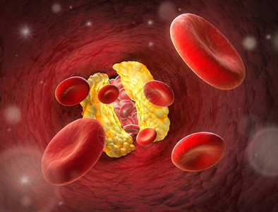 红细胞血管变窄Erythrozyt图片