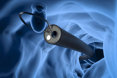 腔镜手术3d使X射线内视镜用铁丝设计图片