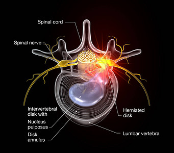 脊神经黑色背景的3D医学图解设计图片