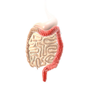 溃疡性的显示溃疡结肠炎UC结肠和直肌炎症和溃疡的3D插图设计图片