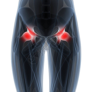 人体骨质联合疼痛解剖HipPain3图片