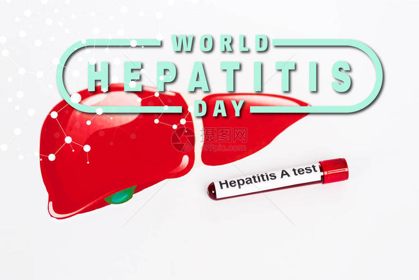 肝炎样本在世界肝炎日附近进行测试并在白图片