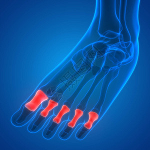 人体骨联合疼痛脚关节和骨头3图片