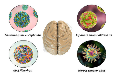 黄病毒脑感染微生物引起脑炎和插画