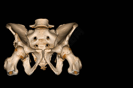 牛窝骨骨盆CT扫描3D渲染图像显示设计图片