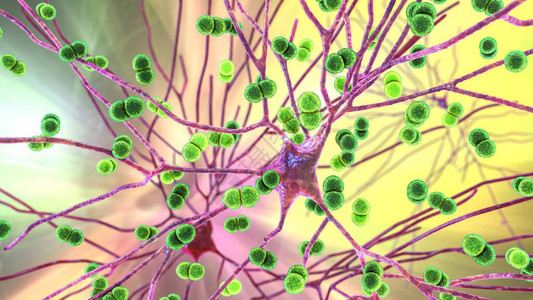 感染神经元脑细胞的链球菌球菌和其他细菌脑炎脑膜炎脑组织细菌感染的概念插画