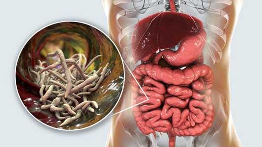 人类肠胃中的寄生虫图片