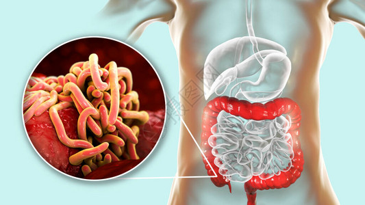 人类大型肠道中的寄生虫高清图片