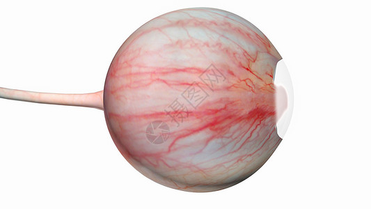 视网膜血管翼状胬肉设计图片