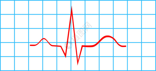 电动心电图矢量一中的正常气态和脉背景图片