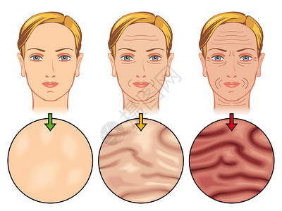 肤质管理人体皮肤老化插画