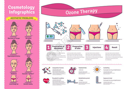 矢量插图集美容臭氧治疗图片