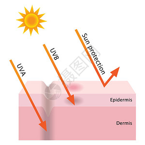 乌瓦罗瓦信息图表皮肤插图信息图表皮肤插图UVA和UVB穿透人体皮肤防晒霜保护插画