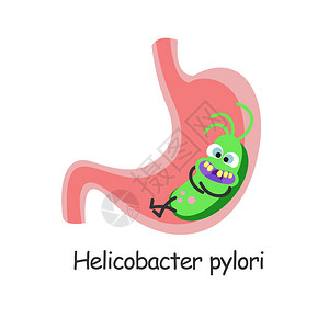 胃部的有害细菌矢量插图图片