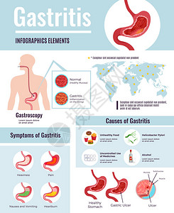 慢性萎缩性胃炎胃炎图表海报插画