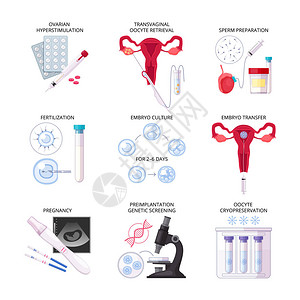 胚胎学配有受孕胚胎培养转移和其他描述矢量插图的分离式平板体外受精插画