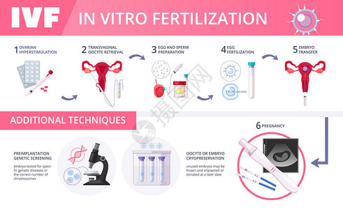 胚胎学带有附加技术步骤的彩色体外受精IVF平面信息插画