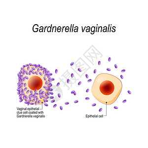 gardnerella微生物癌症高清图片