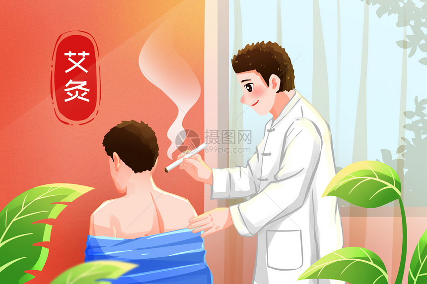 养生中国中医艾灸理疗插画图片