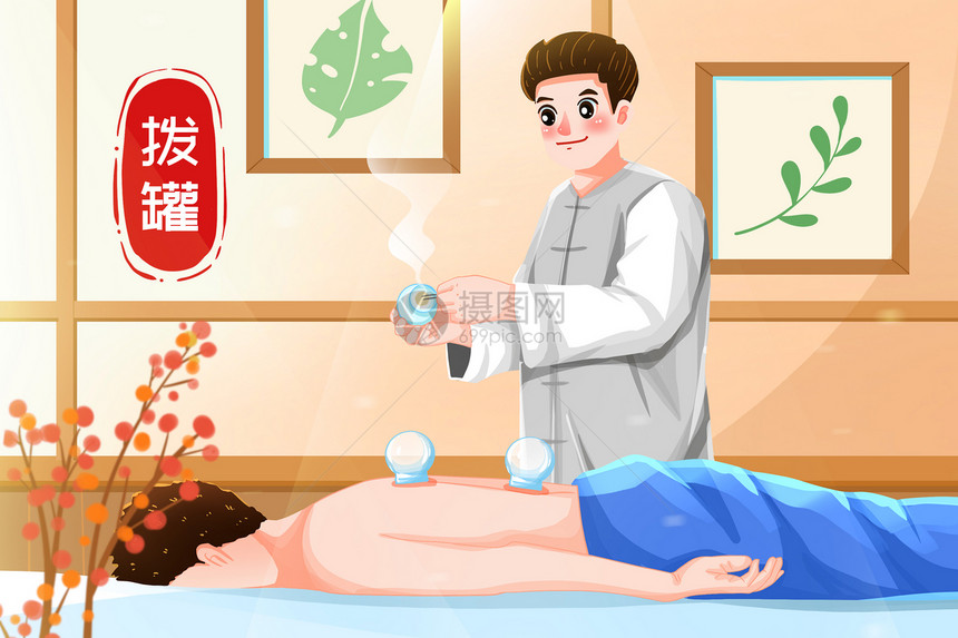 养生中国中医背部拔罐去湿气插画图片