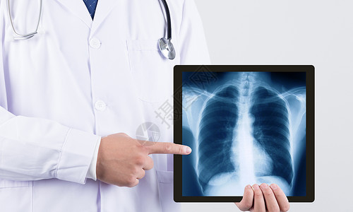 健康知识宣传医生在讲解胸腔知识设计图片