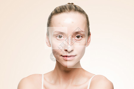 自然脸粉刺皮肤设计图片