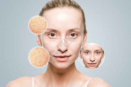 面部干燥皮肤改善高清图片