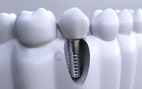 牙齿健康3D牙齿高清图片